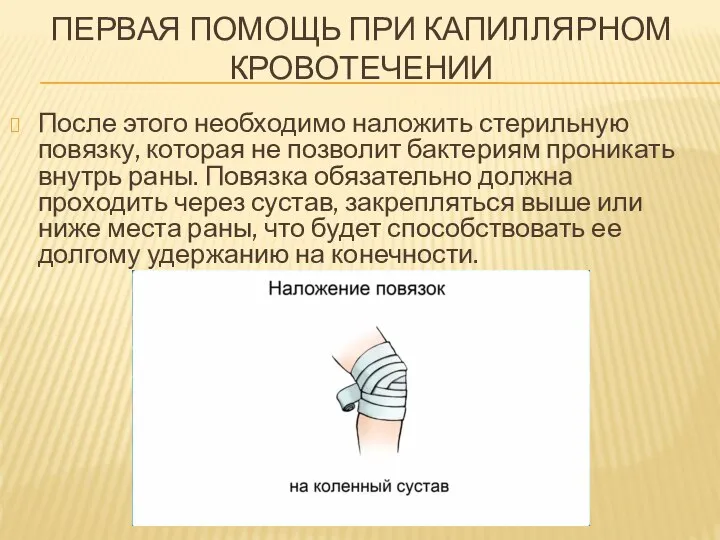 ПЕРВАЯ ПОМОЩЬ ПРИ КАПИЛЛЯРНОМ КРОВОТЕЧЕНИИ После этого необходимо наложить стерильную повязку,