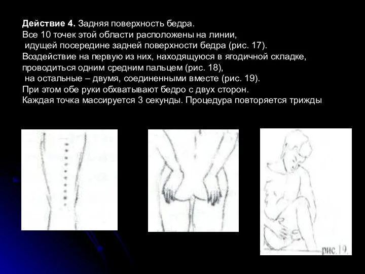 Действие 4. Задняя поверхность бедра. Все 10 точек этой области расположены