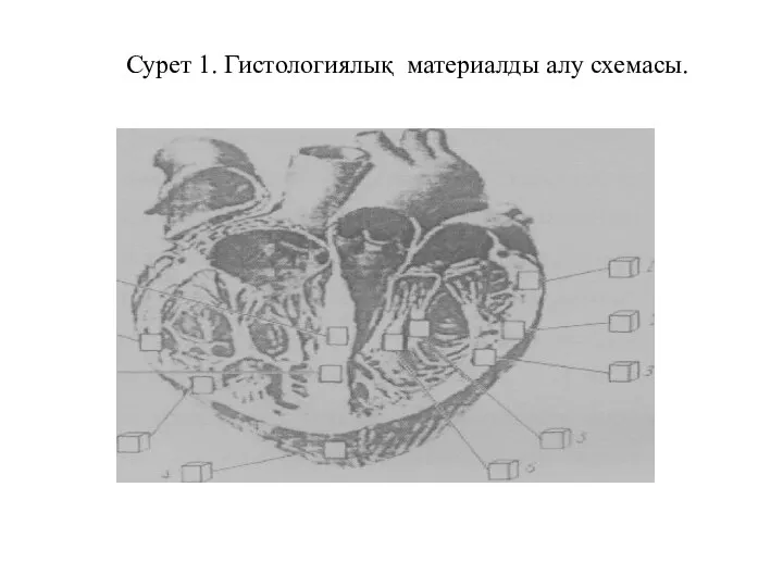 Сурет 1. Гистологиялық материалды алу схемасы.