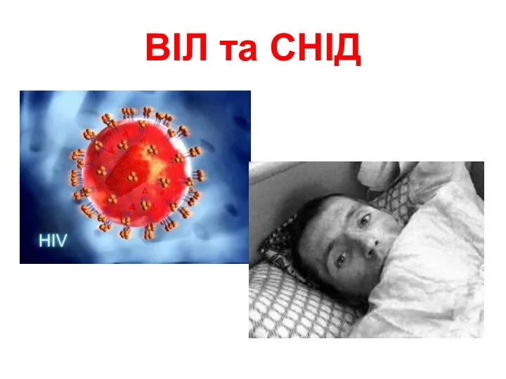 ВІЛ та CНІД