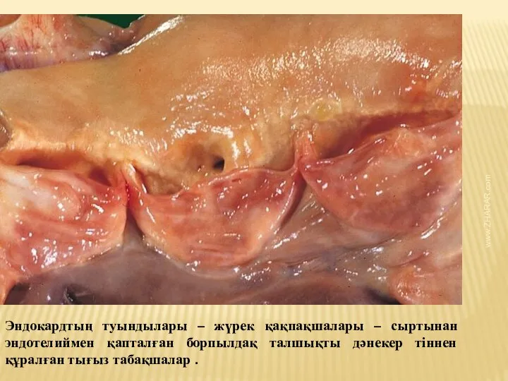 Эндокардтың туындылары – жүрек қақпақшалары – сыртынан эндотелиймен қапталған борпылдақ талшықты