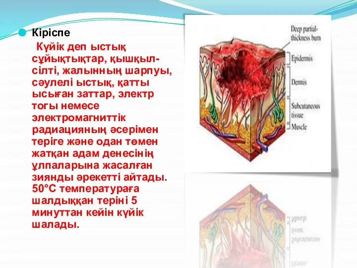 Кіріспе Күйік деп ыстық сұйықтықтар, қышқыл-сілті, жалынның шарпуы, сәулелі ыстық, қатты