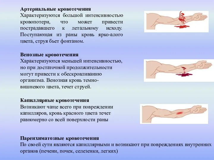 Артериальные кровотечения Характеризуются большой интенсивностью кровопотери, что может привести пострадавшего к