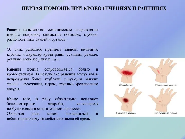 ПЕРВАЯ ПОМОЩЬ ПРИ КРОВОТЕЧЕНИЯХ И РАНЕНИЯХ Ранами называются механические повреждения кожных