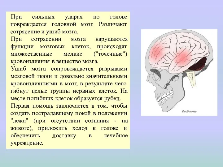 При сильных ударах по голове повреждается головной мозг. Различают сотрясение и