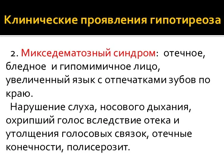 Клинические проявления гипотиреоза 2. Микседематозный синдром: отечное, бледное и гипомимичное лицо,