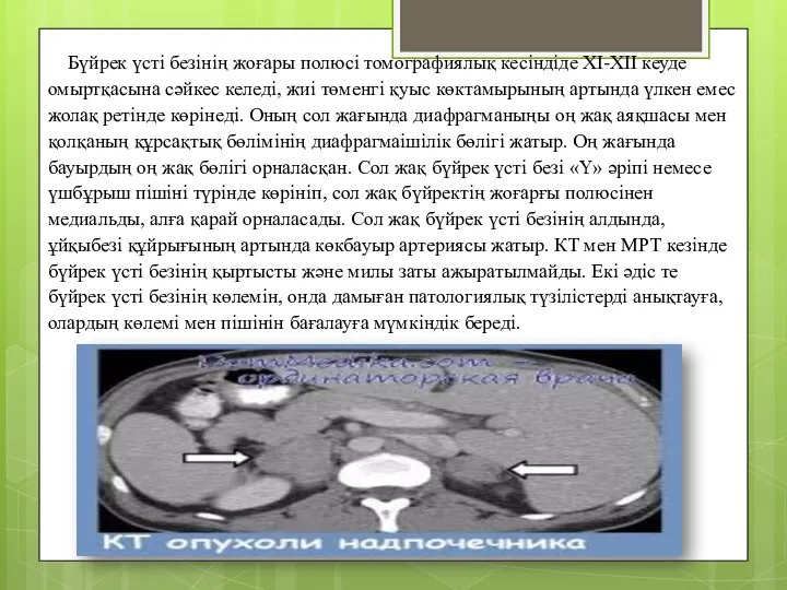 Бүйрек үсті безінің жоғары полюсі томографиялық кесіндіде XI-XII кеуде омыртқасына сәйкес