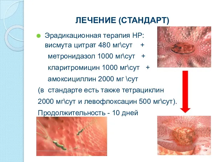 ЛЕЧЕНИЕ (СТАНДАРТ) Эрадикационная терапия НР: висмута цитрат 480 мг\сут + метронидазол