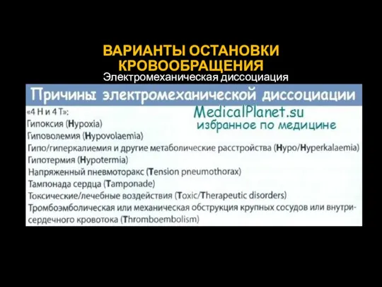 ВАРИАНТЫ ОСТАНОВКИ КРОВООБРАЩЕНИЯ Электромеханическая диссоциация