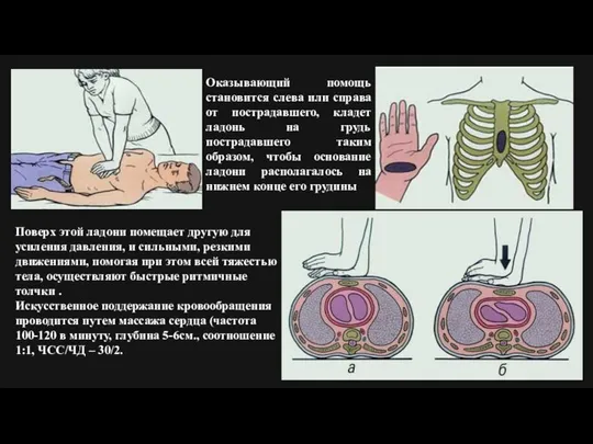 Оказывающий помощь становится слева или справа от пострадавшего, кладет ладонь на