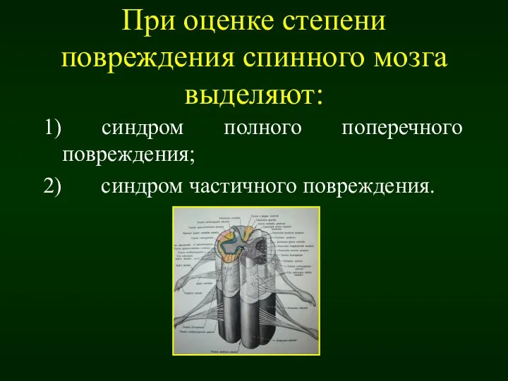 При оценке степени повреждения спинного мозга выделяют: 1) синдром полного поперечного повреждения; 2) синдром частичного повреждения.