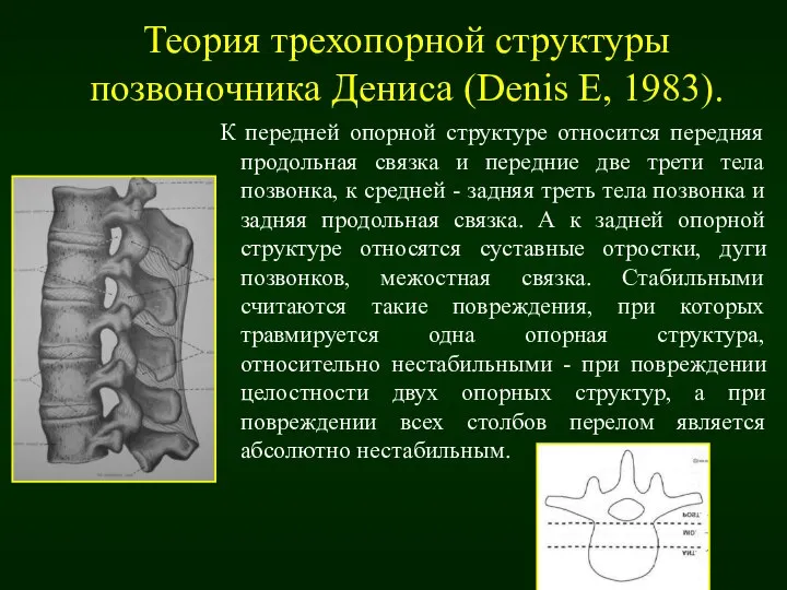 Теория трехопорной структуры позвоночника Дениса (Denis E, 1983). К передней опорной