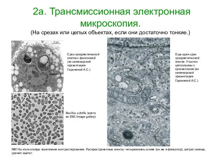 2а. Трансмиссионная электронная микроскопия. (На срезах или целых объектах, если они