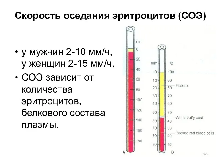 Скорость оседания эритроцитов (СОЭ) у мужчин 2-10 мм/ч, у женщин 2-15