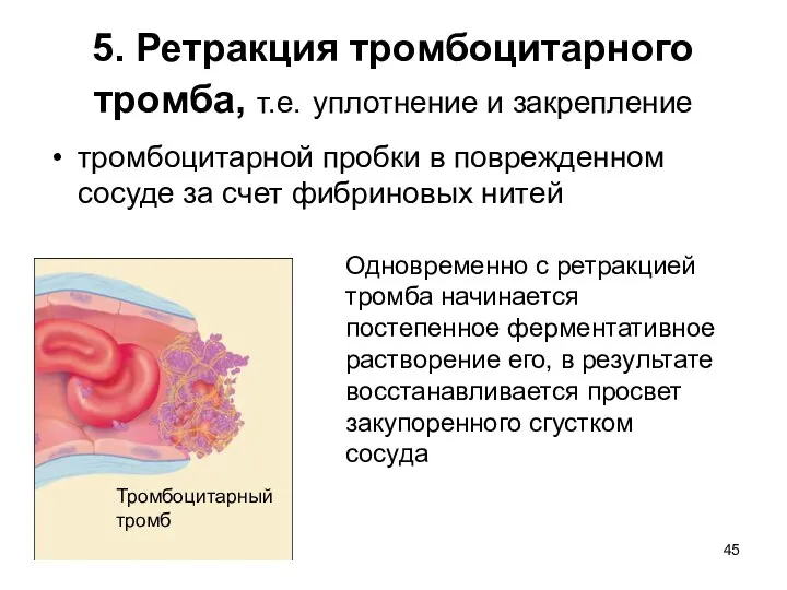 5. Ретракция тромбоцитарного тромба, т.е. уплотнение и закрепление тромбоцитарной пробки в