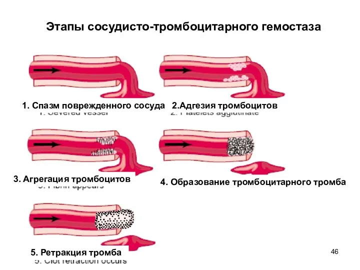 Этапы сосудисто-тромбоцитарного гемостаза 1. Спазм поврежденного сосуда 3. Агрегация тромбоцитов 5.