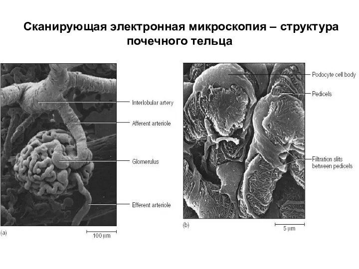 Сканирующая электронная микроскопия – структура почечного тельца