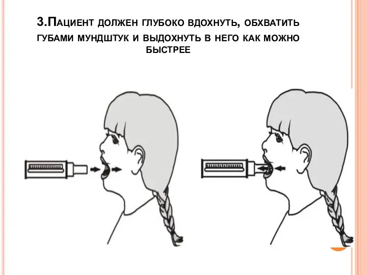 3.Пациент должен глубоко вдохнуть, обхватить губами мундштук и выдохнуть в него как можно быстрее