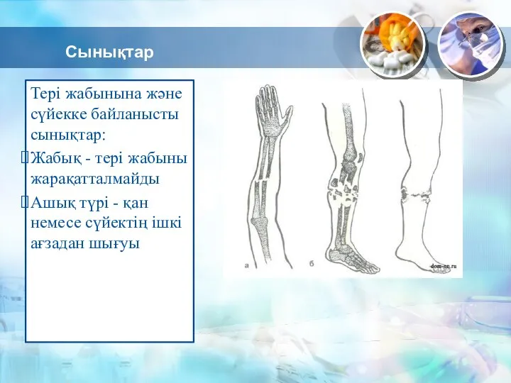 Сынықтар Тері жабынына және сүйекке байланысты сынықтар: Жабық - тері жабыны