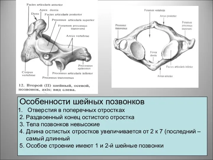 Особенности шейных позвонков Отверстия в поперечных отростках 2. Раздвоенный конец остистого