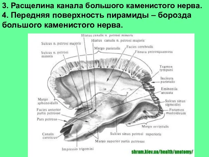 3. Расщелина канала большого каменистого нерва. 4. Передняя поверхность пирамиды – борозда большого каменистого нерва.