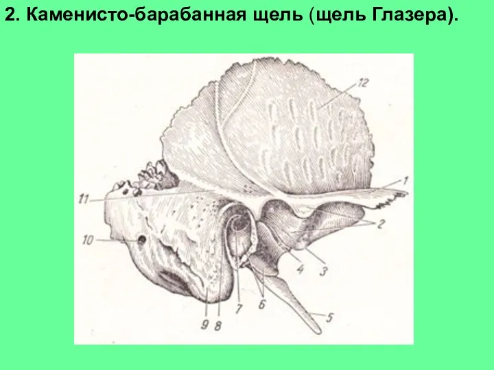 2. Каменисто-барабанная щель (щель Глазера).