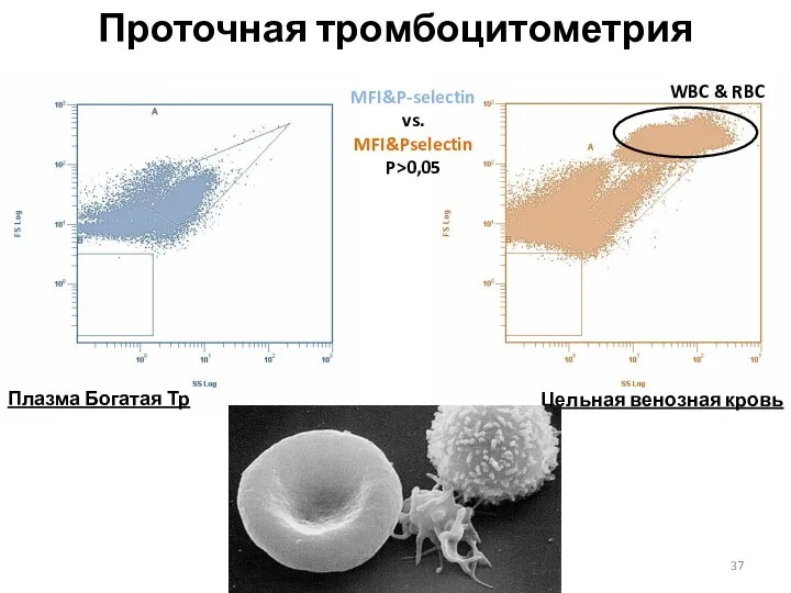 Проточная тромбоцитометрия Цельная венозная кровь Плазма Богатая Тр WBC & RBC MFI&P-selectin vs. MFI&Pselectin P>0,05