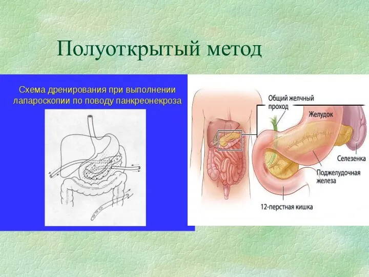 Полуоткрытый метод