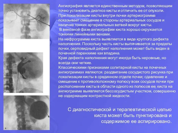 С диагностической и терапевтической целью киста может быть пунктирована и содержимое