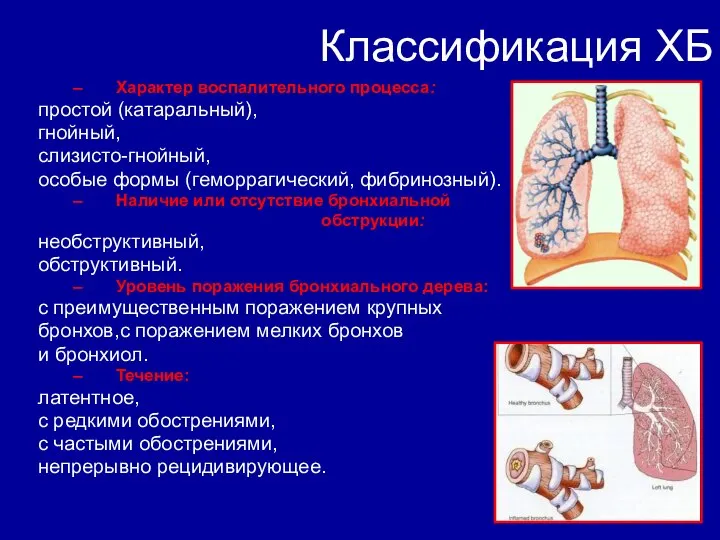 Классификация ХБ Характер воспалительного процесса: простой (катаральный), гнойный, слизисто-гнойный, особые формы