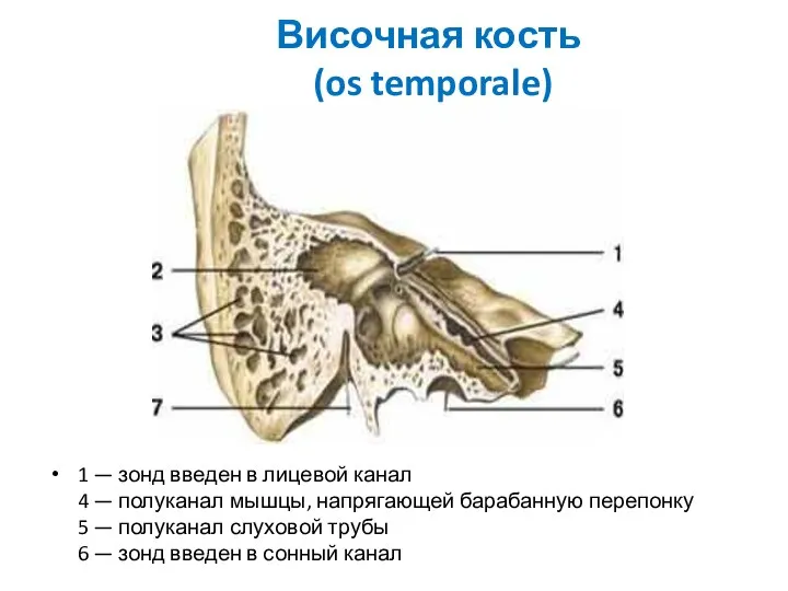 Височная кость (os temporale) 1 — зонд введен в лицевой канал
