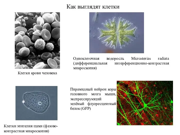 Как выглядят клетки Клетки крови человека Одноклеточная водоросль Micrasterias radiata (дифференциальная