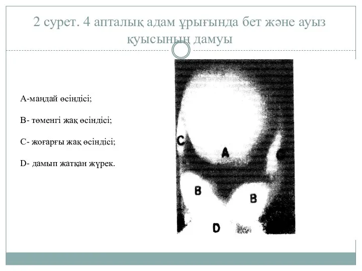 2 сурет. 4 апталық адам ұрығында бет және ауыз қуысының дамуы