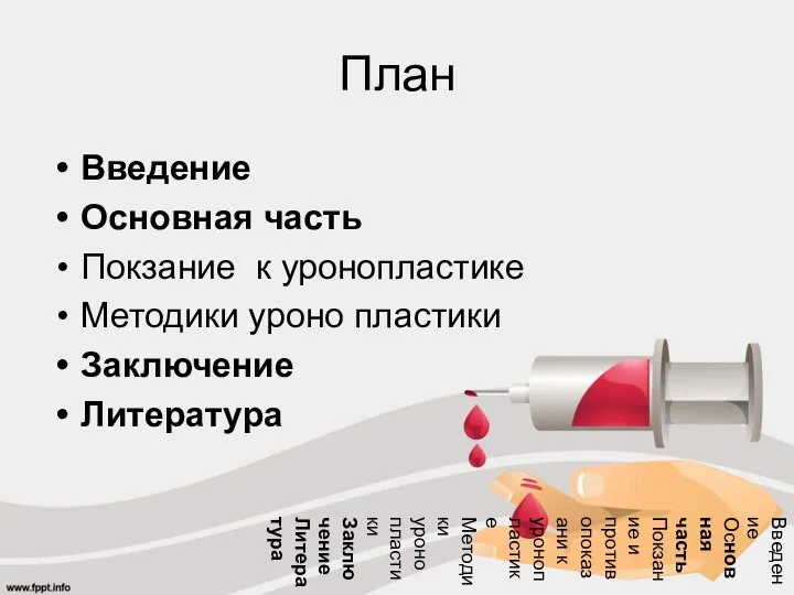 План Введение Основная часть Покзание к уронопластике Методики уроно пластики Заключение