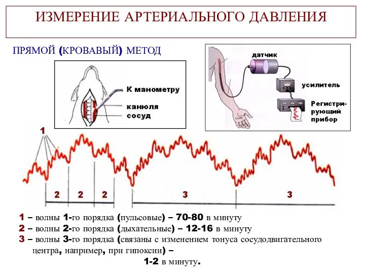 ИЗМЕРЕНИЕ АРТЕРИАЛЬНОГО ДАВЛЕНИЯ ПРЯМОЙ (КРОВАВЫЙ) МЕТОД 1 – волны 1-го порядка