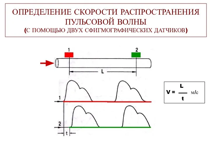 ОПРЕДЕЛЕНИЕ СКОРОСТИ РАСПРОСТРАНЕНИЯ ПУЛЬСОВОЙ ВОЛНЫ (С ПОМОЩЬЮ ДВУХ СФИГМОГРАФИЧЕСКИХ ДАТЧИКОВ) L V = м/с t