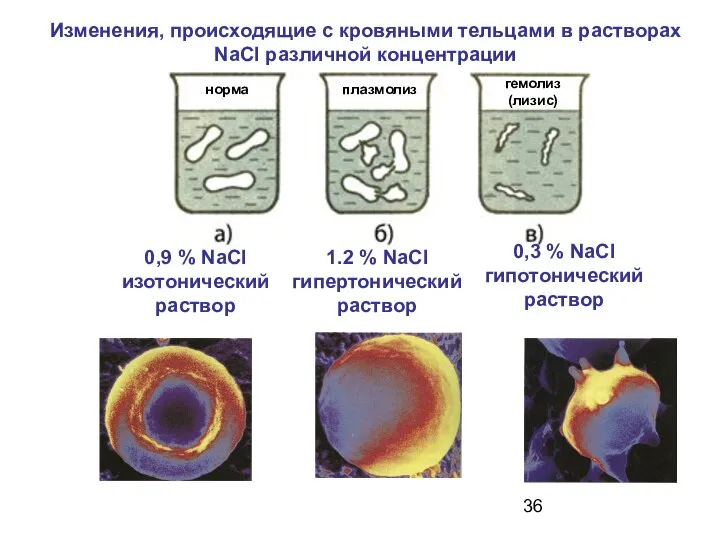 Изменения, происходящие с кровяными тельцами в растворах NaCl различной концентрации норма