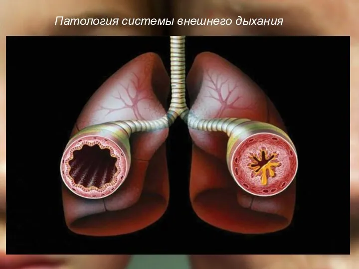 Патология системы внешнего дыхания