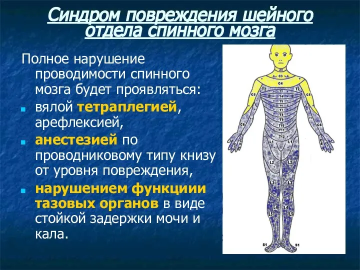 Синдром повреждения шейного отдела спинного мозга Полное нарушение проводимости спинного мозга