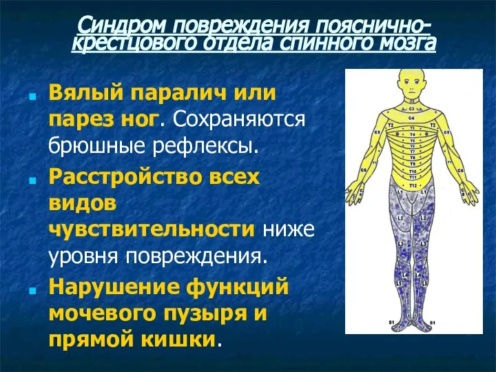 Синдром повреждения пояснично-крестцового отдела спинного мозга Вялый паралич или парез ног.