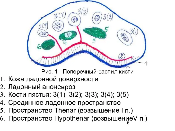 Рис. 1 Поперечный распил кисти Кожа ладонной поверхности Ладонный апоневроз Кости