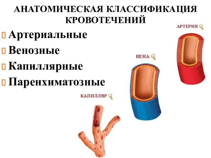 АНАТОМИЧЕСКАЯ КЛАССИФИКАЦИЯ КРОВОТЕЧЕНИЙ Артериальные Венозные Капиллярные Паренхиматозные