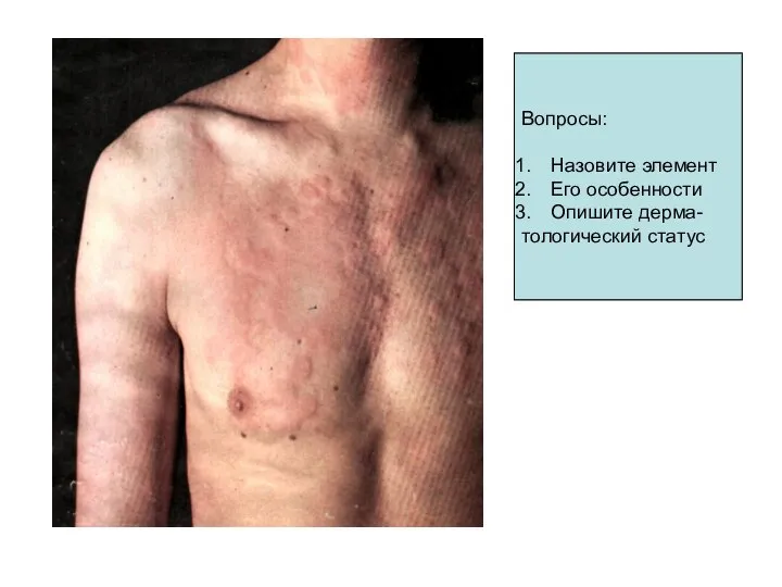 Вопросы: Назовите элемент Его особенности Опишите дерма- тологический статус Вопросы: Назовите