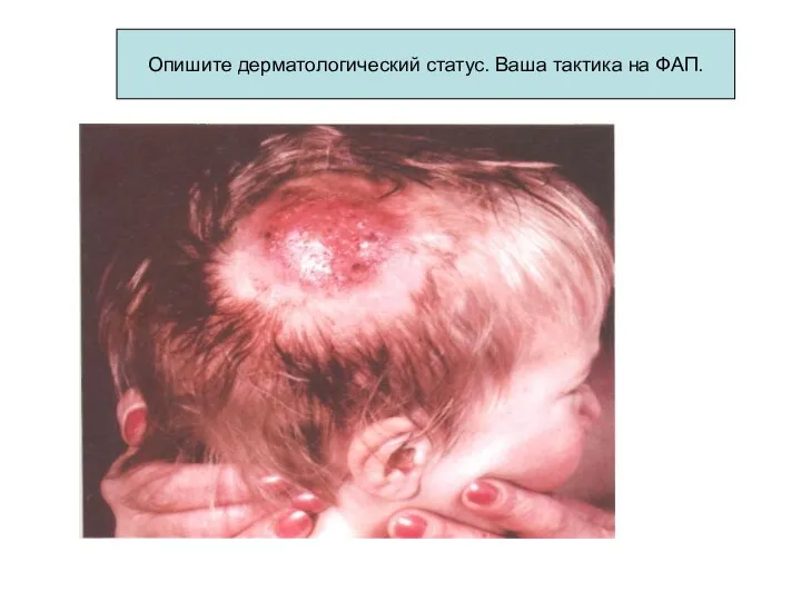 Опишите дерматологический статус. Ваша тактика на ФАП.
