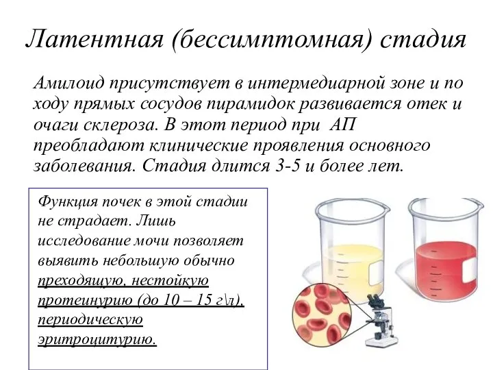 Латентная (бессимптомная) стадия Амилоид присутствует в интермедиарной зоне и по ходу