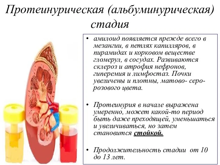 Протеинурическая (альбуминурическая) стадия амилоид появляется прежде всего в мезангии, в петлях