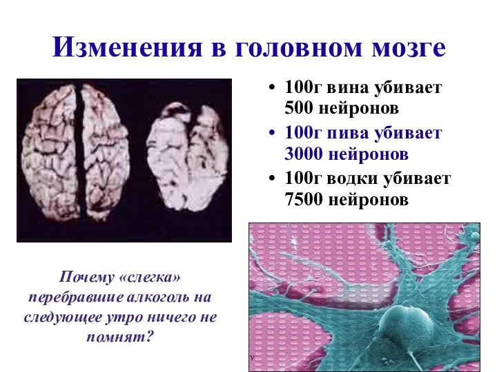 Изменения в головном мозге 100г вина убивает 500 нейронов 100г пива