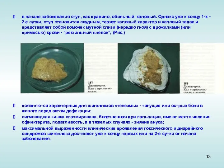 в начале заболевания стул, как правило, обильный, каловый. Однако уже к