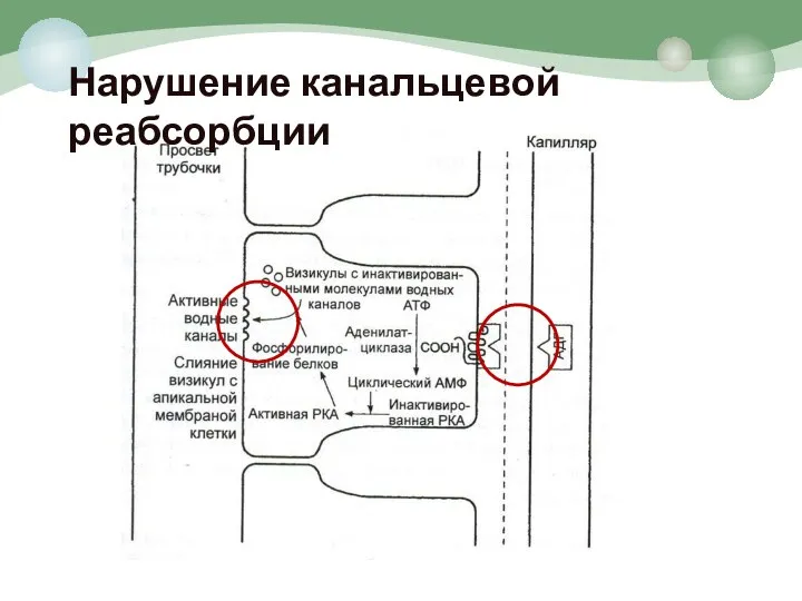 Нарушение канальцевой реабсорбции