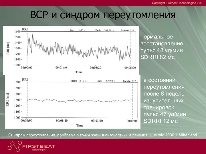 нормальное восстановление пульс 48 уд/мин SDRRI 82 мс в состоянии переутомления